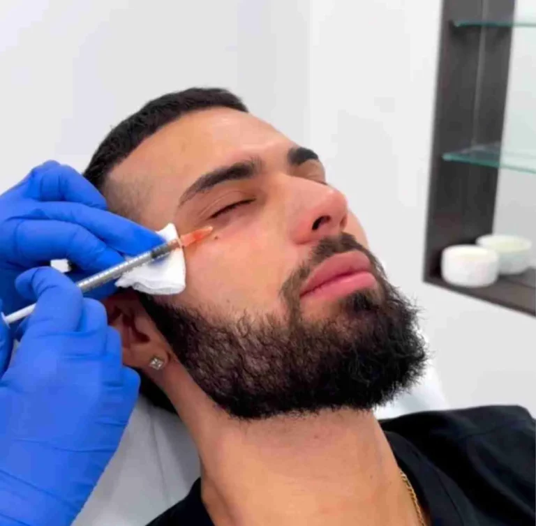 prf under eye treatment